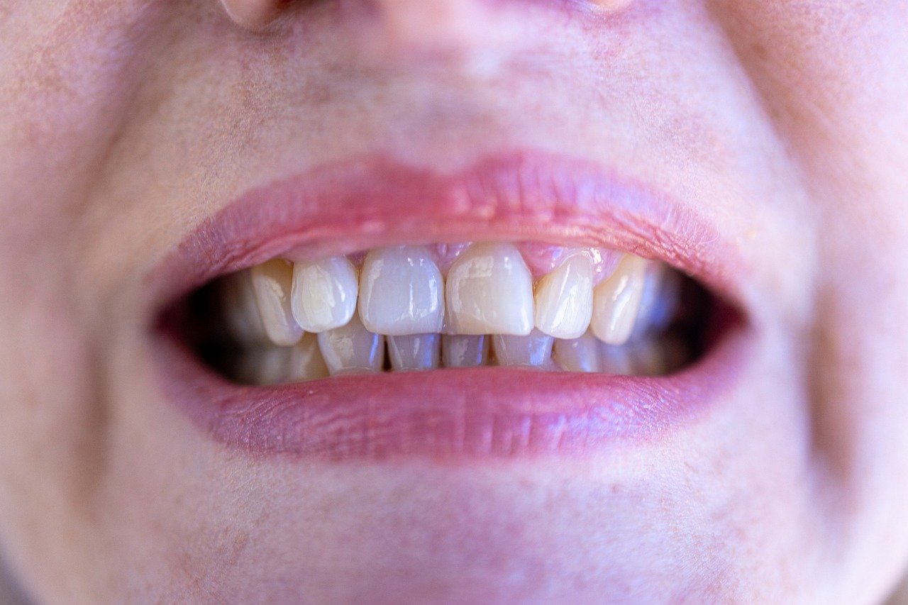 Dix aliments à favoriser pour ne pas avoir de caries
